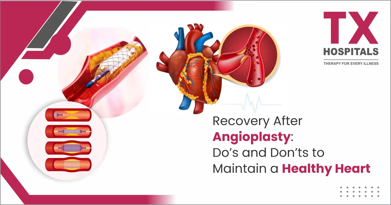 Recovery After Angioplasty: Do’s and Don’ts to Maintain a Healthy Heart